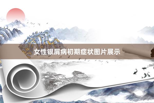 女性银屑病初期症状图片展示